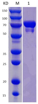 12% SDS-PAGE analysis profiles of purified NTHI1969-28-693 (CBB stained).